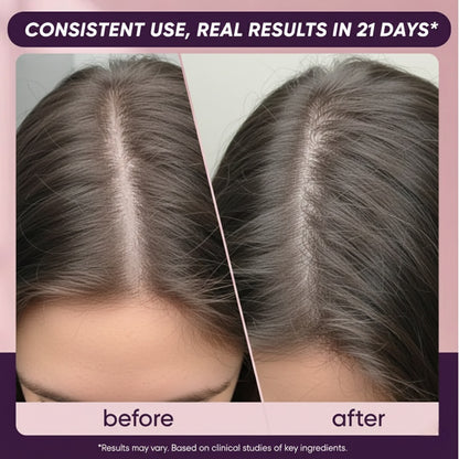 Hair Growth Soft Chews for Healthy Hair