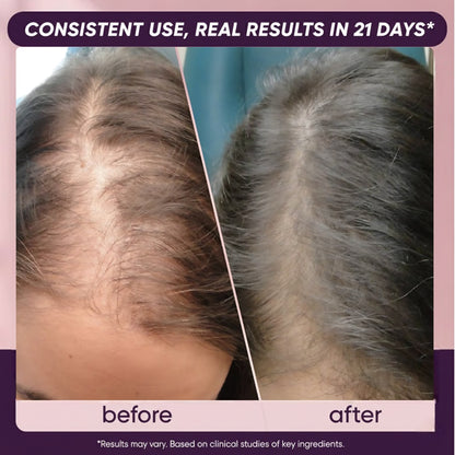 Hair Growth Soft Chews for Healthy Hair