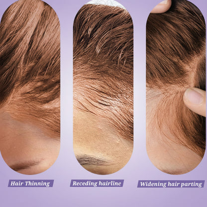 Hair Growth Essence roll-on