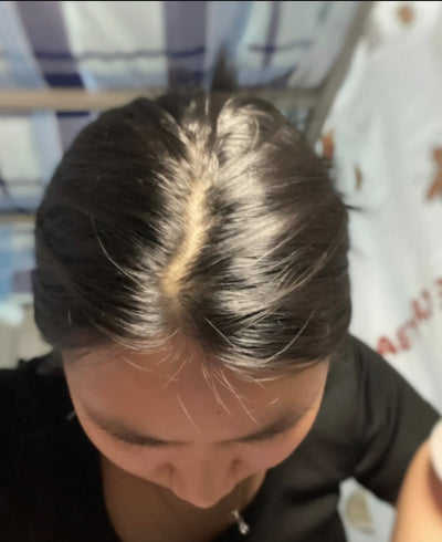 Before